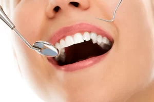 Emergency-Dentist-Treatment-In-Belleville-On