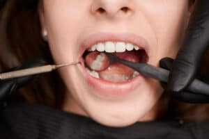 teeth problems after pregnancy